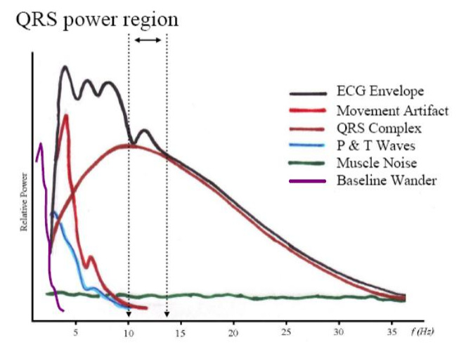 QRS%20detection